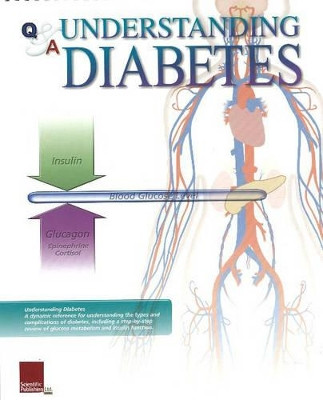 Understanding Diabetes Flip Chart by Scientific Publishing 9781932922325