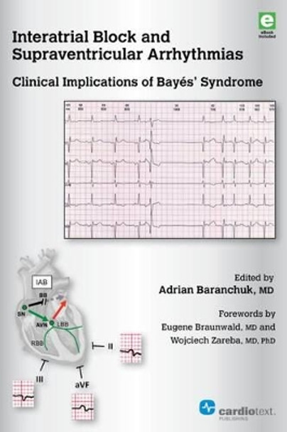 Interatrial Block and Supraventricular Arrhythmias: Clinical Implications of Bayes' Syndrome by Adrian Baranchuk 9781942909156