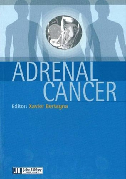 Adrenal Cancer by Xavier Bertagna 9782742005932