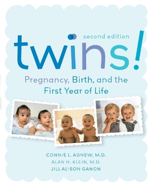 Twins!: Pregnancy, Birth and the First Year of Life by Connie Agnew 9780060742195