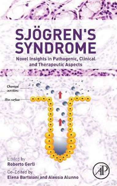 Sjogren's Syndrome: Novel Insights in Pathogenic, Clinical and Therapeutic Aspects by Alessia Alunno 9780128036044