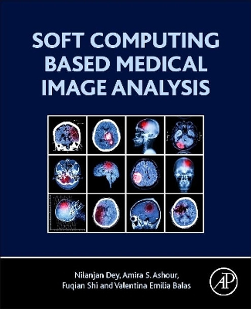 Soft Computing Based Medical Image Analysis by Nilanjan Dey 9780128130872