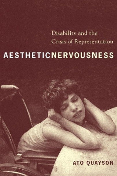 Aesthetic Nervousness: Disability and the Crisis of Representation by Ato Quayson 9780231139038