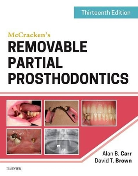 McCracken's Removable Partial Prosthodontics by Alan B. Carr 9780323339902