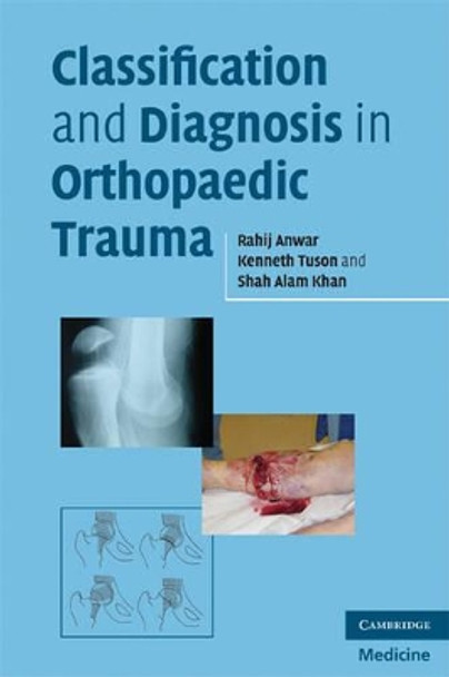 Classification and Diagnosis in Orthopaedic Trauma by Rahij Anwar 9780521700283