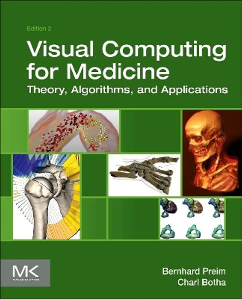 Visual Computing for Medicine: Theory, Algorithms, and Applications by Bernhard Preim 9780124158733