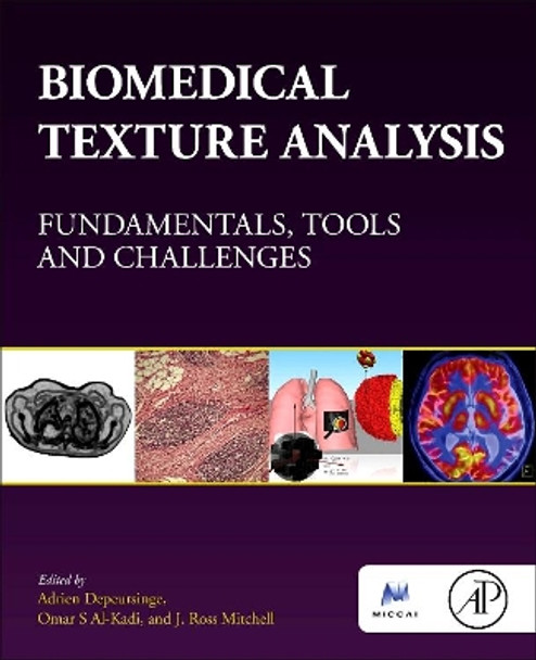 Biomedical Texture Analysis: Fundamentals, Tools and Challenges by Adrien Depeursinge 9780128121337