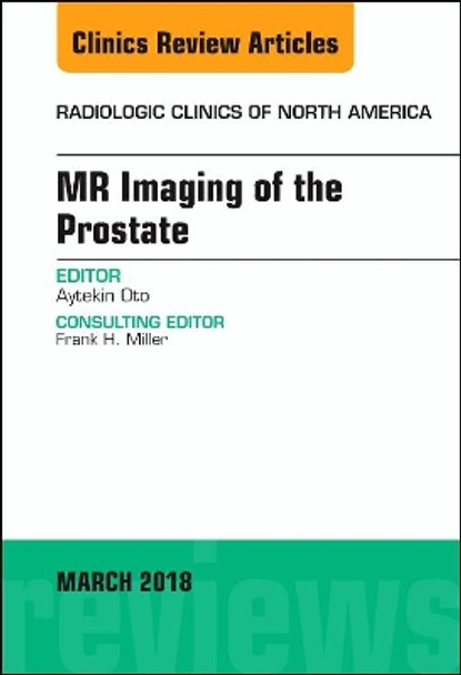 MR Imaging of the Prostate, An Issue of Radiologic Clinics of North America by Oto 9780323581721