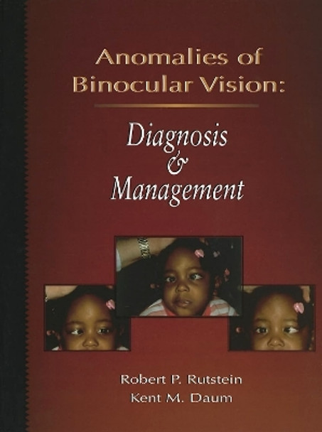 Anomalies Of Binocular Vision: Diagnosis And Management by Robert P. Rutstein 9780801669163