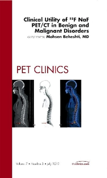 Clinical Utility of 18NaF PET/CT in Benign and Malignant Disorders, An Issue of PET Clinics by Mohsen Beheshti 9781455748860