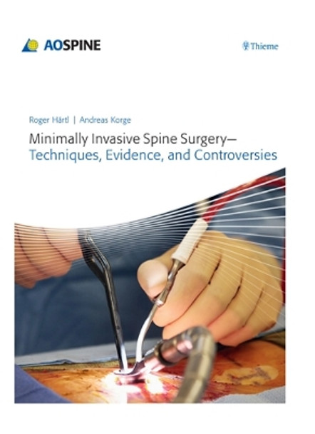 Minimally Invasive Spine Surgery: Techniques, Evidence, and Controversies by Roger Haertl 9783131723819