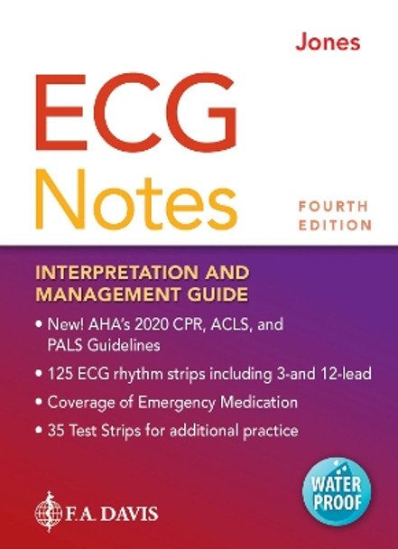 ECG Notes: Interpretation and Management Guide by Shirley A. Jones 9781719641944