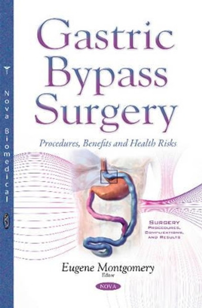 Gastric Bypass Surgery: Procedures, Benefits & Health Risks by Eugene Montgomery 9781634854122