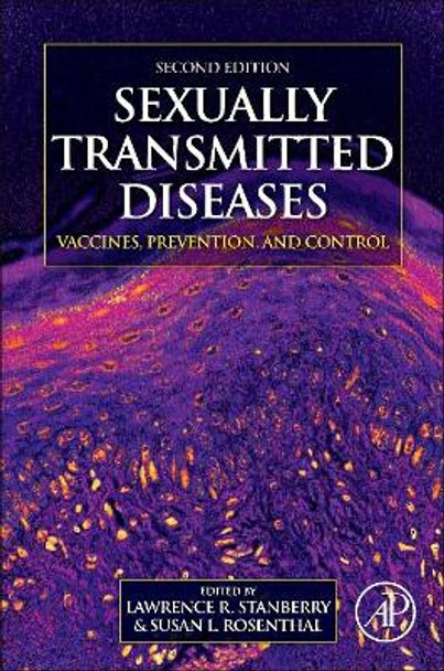 Sexually Transmitted Diseases: Vaccines, Prevention, and Control by Susan Rosenthal 9780123910592