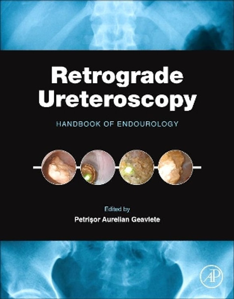 Retrograde Ureteroscopy: Handbook of Endourology by Petrisor Aurelian Geavlete 9780128024034