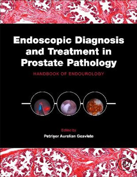 Endoscopic Diagnosis and Treatment in Prostate Pathology: Handbook of Endourology by Petrisor Aurelian Geavlete 9780128024058