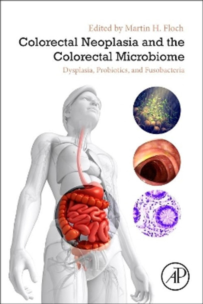 Colorectal Neoplasia and the Colorectal Microbiome: Dysplasia, Probiotics, and Fusobacteria by Martin H. Floch 9780128196724
