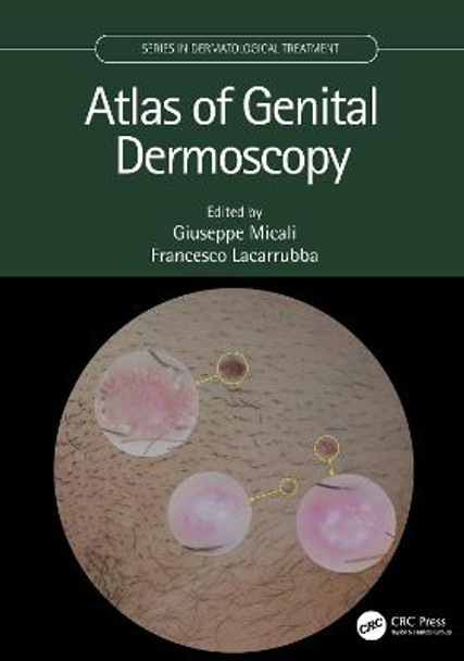 Atlas of Genital Dermoscopy by Giuseppe Micali