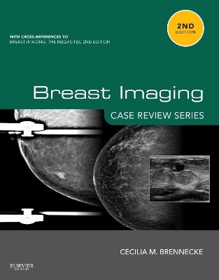 Breast Imaging: Case Review Series by Cecilia M. Brennecke 9780323087223