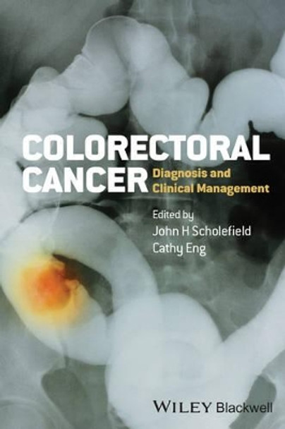 Colorectal Cancer: Diagnosis and Clinical Management by John H. Scholefield 9780470674802