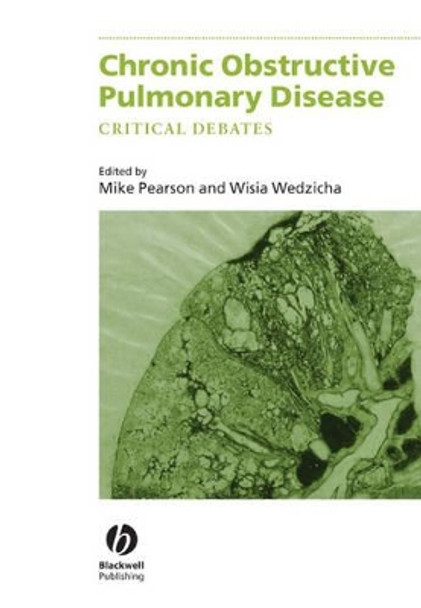Chronic Obstructive Pulmonary Disease: Critical Debates by Michael Pearson 9780632059720