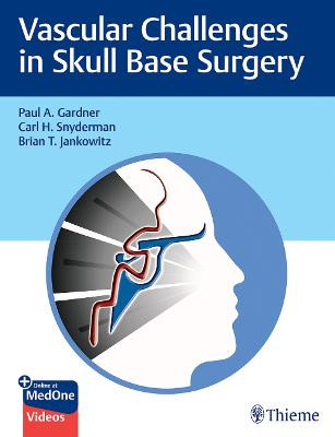 Vascular Challenges in Skull Base Surgery Paul Gardner 9781684200689