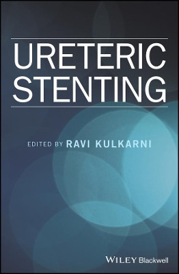 Ureteric Stenting by Ravi Kulkarni 9781119085683