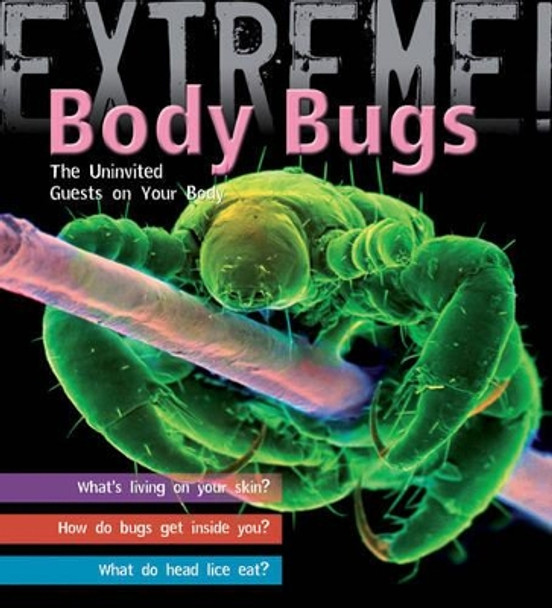 Extreme Science: Body Bugs!: The Uninvited Guests on Your Body by Trevor Day 9781408100936