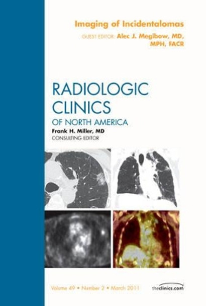 Imaging of Incidentalomas, An Issue of Radiologic Clinics of North America by Alec J. Megibow 9781455705016