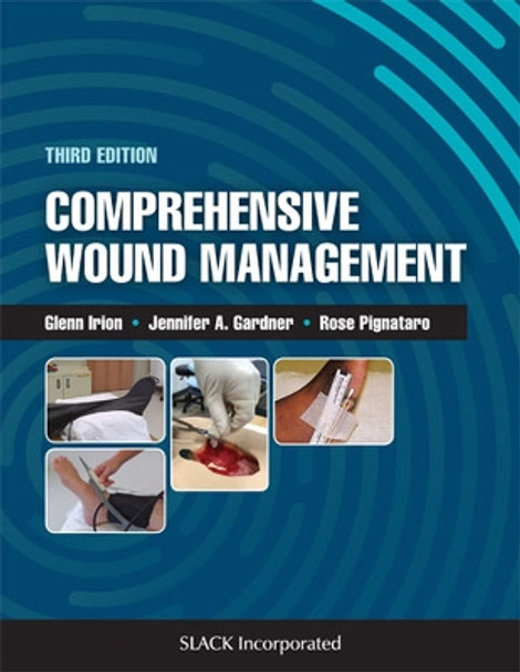 Comprehensive Wound Management by Glenn Irion 9781630915216