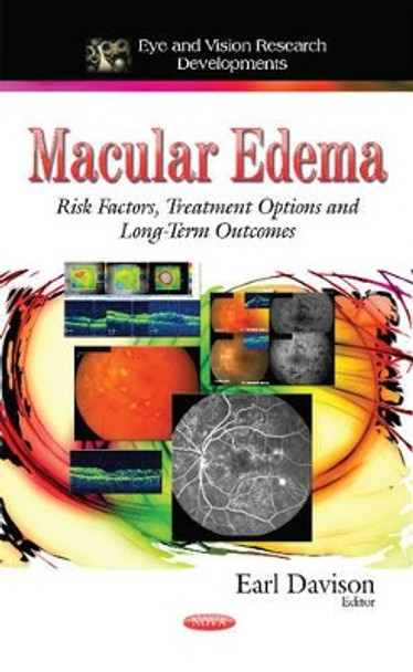 Macular Edema: Risk Factors, Treatment Options and Long-Term Outcomes by Earl Davison 9781633215849