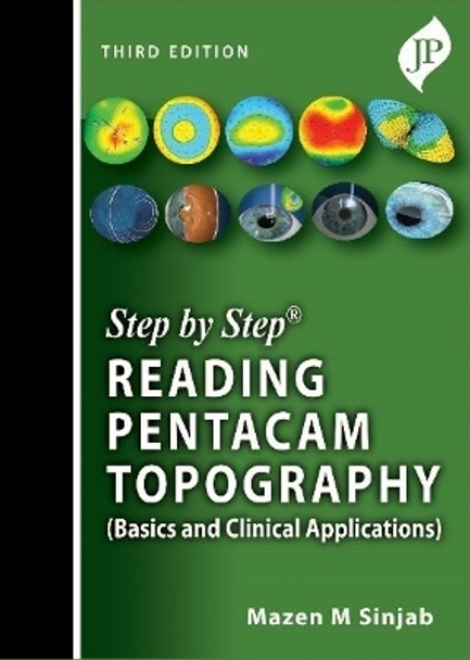 Step by Step: Reading Pentacam Topography: Basics and Clinical Applications by Mazen M Sinjab 9781787791299