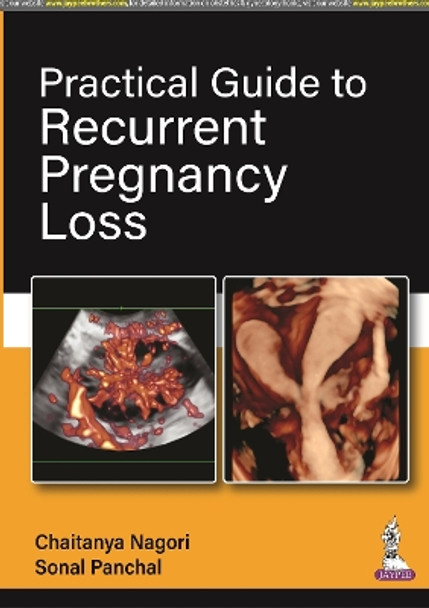 Practical Guide to Recurrent Pregnancy Loss by Chaitanya Nagori 9789354656644