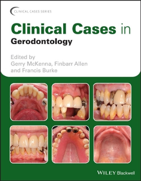 Clinical Cases in Gerodontology by Gerry McKenna 9781119226598