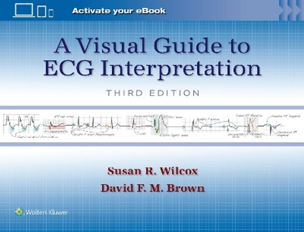 A Visual Guide to ECG Interpretation by Susan Renee Wilcox 9781975213589