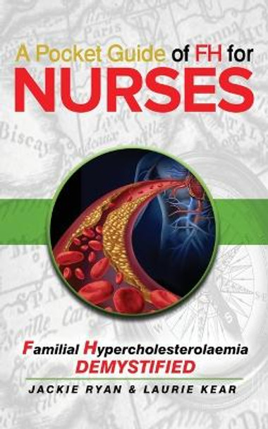 A Pocket Guide of FH for Nurses: Detection and Diagnosis of Familial Hypercholestrolaemia by Jackie Ryan 9780648627043
