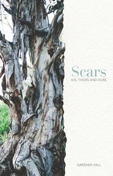 Scars: His, Theirs and Ours by Gardner Hall 9780985005948