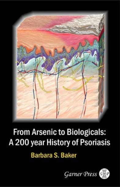 From Arsenic to Biologicals: A 200 Year History of Psoriasis by Barbara S. Baker 9780955160325