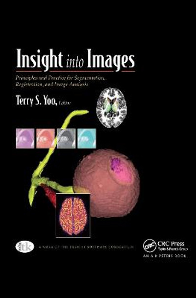 Insight into Images: Principles and Practice for Segmentation, Registration, and Image Analysis by Terry S. Yoo