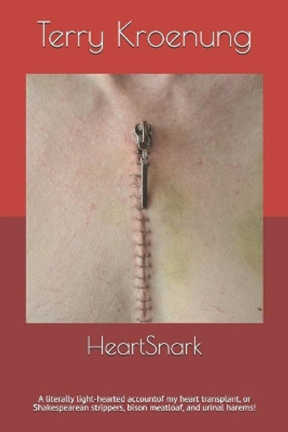 HeartSnark: A literally light-hearted account of my heart transplant, or Shakespearean strippers, bison meatloaf, and urinal harems! by Terry Kroenung 9780578576725