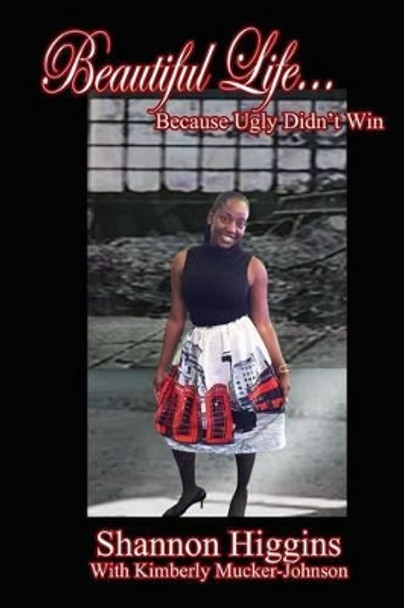 Beautiful Life...Because Ugly Didn't Win by Kimberly A Mucker-Johnson 9780692715512