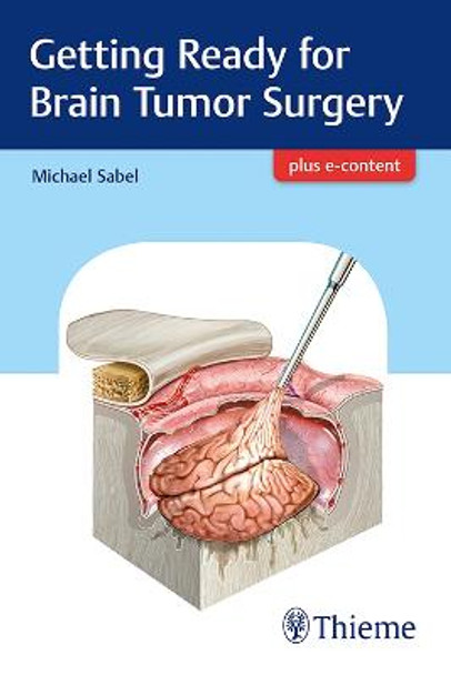 Getting Ready for Brain Tumor Surgery by Michael Sabel