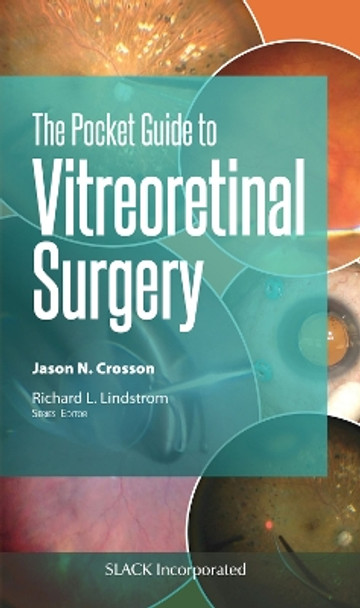 The Pocket Guide to Vitreoretinal Surgery by Jason Crosson 9781630916961