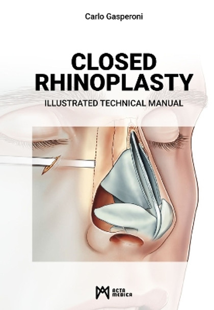 Closed Rhinoplasty: Illustrated Technical Manual by Carlo Gasperoni 9788897438717