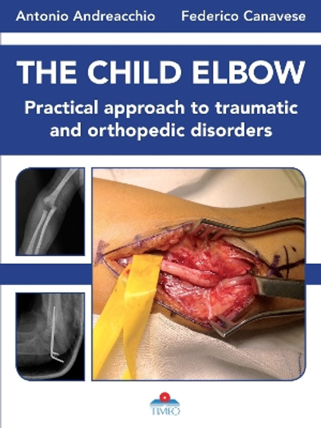 The Child Elbow: Practical Approach to Traumatic and Orthopedic Disorders by Antonio Andreacchio 9788897162827