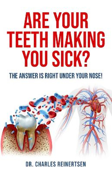 Are Your Teeth Making You Sick?: The Answer is Right Under Your Nose by Charles W Reinertsen 9781958211144