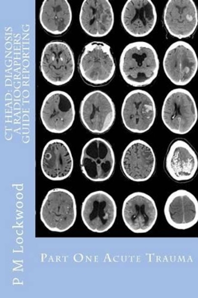 CT Head: DIAGNOSIS A Radiographers Guide To Reporting Part 1 Acute Trauma: Part One Acute Trauma by P M Lockwood 9781467923934