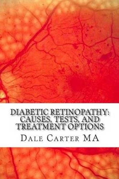 Diabetic Retinopathy: Causes, Tests, and Treatment Options by Edward Montgomery 9781477447628