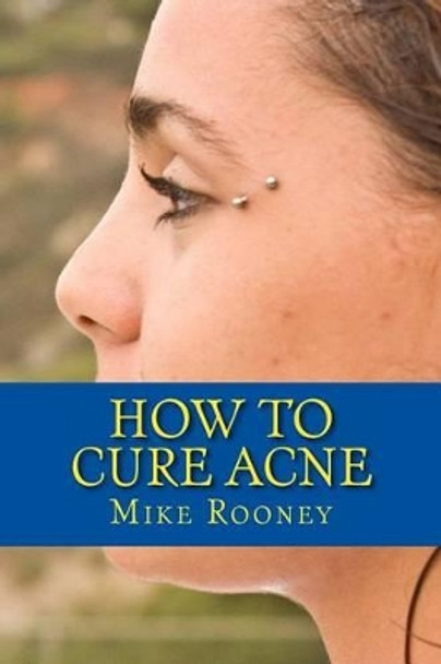 How To Cure Acne: What Is Acne And The Best Treatments For Acne by Mike Rooney 9781482389029