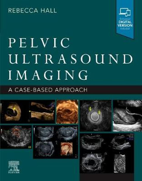 Pelvic Ultrasound Imaging: a Cased-Based Application by Hall